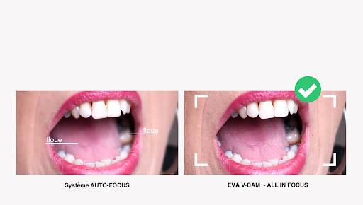 Avant/Après scialytique Faro